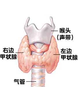 甲亢最新治疗方法概述